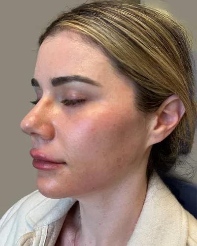 Laser Center of Marin lanza un paquete coordinado de brillo para novias y eventos